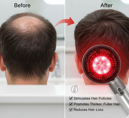 Red light scalp massager