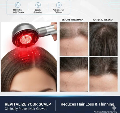 Red light scalp massager